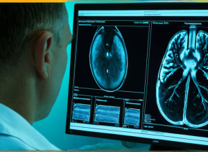 Технологии искусственного интеллекта в медицине