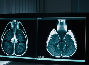 Дональд Трамп обещает обнародовать результаты МРТ, несмотря на отсутствие деталей